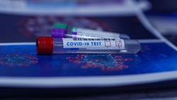 Более 32 тысяч новых экспресс-тестов на COVID-19 поступило в Белгородскую область