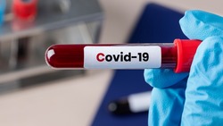 14 человек заболели коронавирусом за минувшую неделю в Белгородском районе