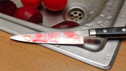 Шебекинец 13 раз ударил знакомого ножом из‑за юношеских обид